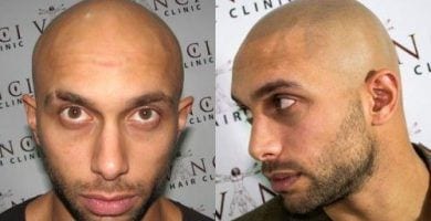 tatuaje pelo 02