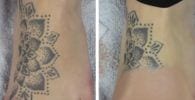 truco borrar tatuaje