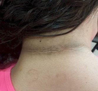 sintomas de diabetes 9