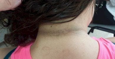 sintomas de diabetes 9