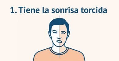 sintomas derrame cerebral