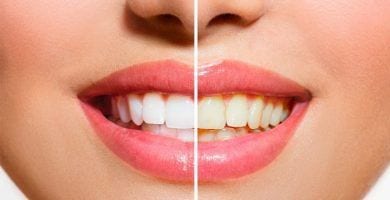 truco blaquear dientes 720